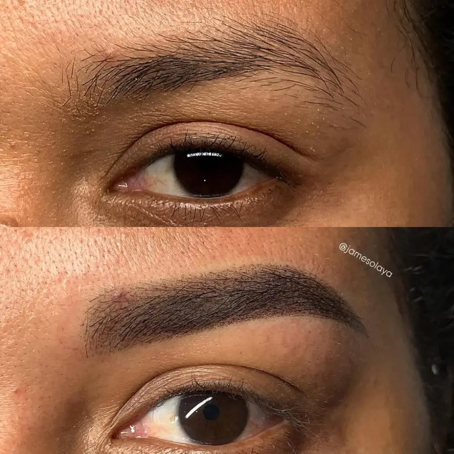 Antes e depois de procedimento — aluna Jay Academy