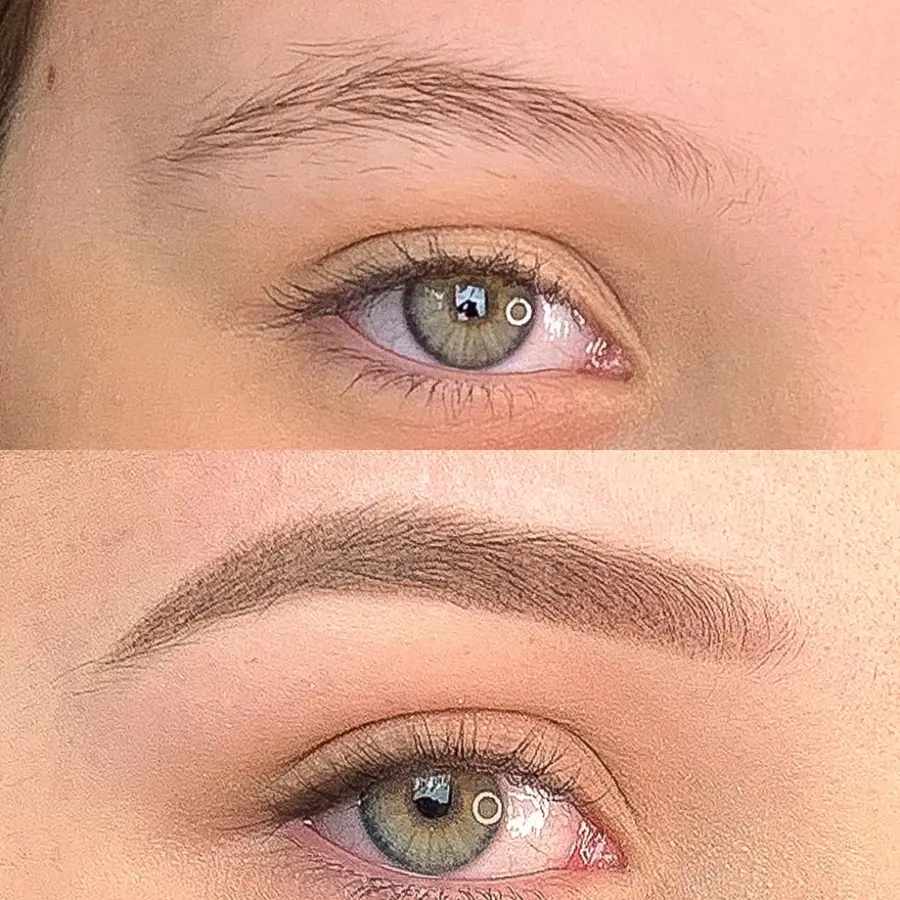 Antes e depois de procedimento — aluna Jay Academy