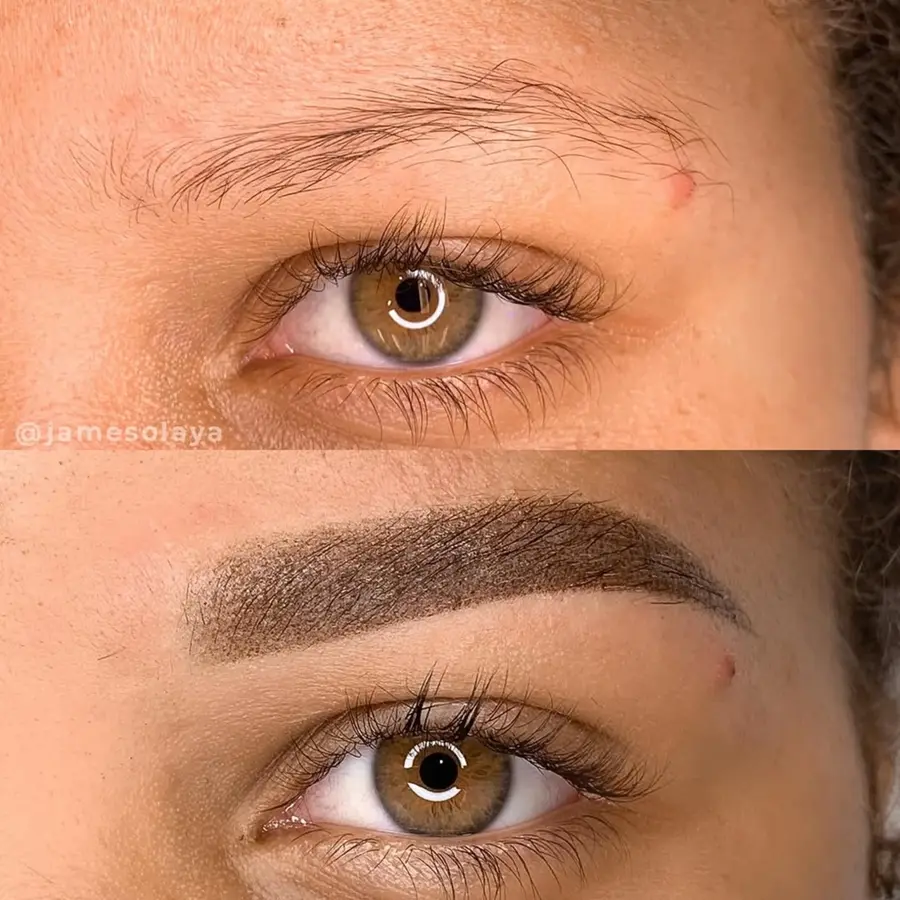 Antes e depois de procedimento — aluna Jay Academy