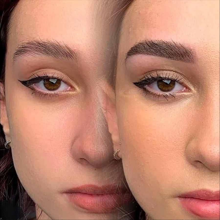 Antes e depois de procedimento — aluna Jay Academy